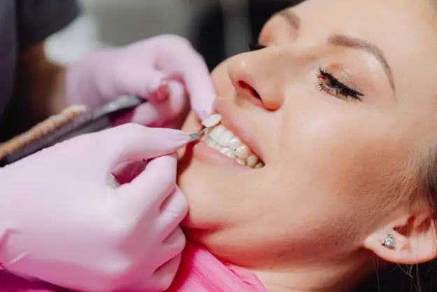 Le 5 principali domande sulle faccette, risposte da un dentista cosmetico