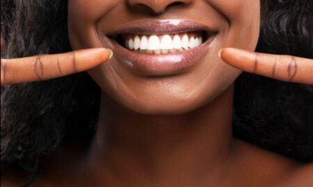 Elevating Smiles: The MySmile Teeth Paradigm